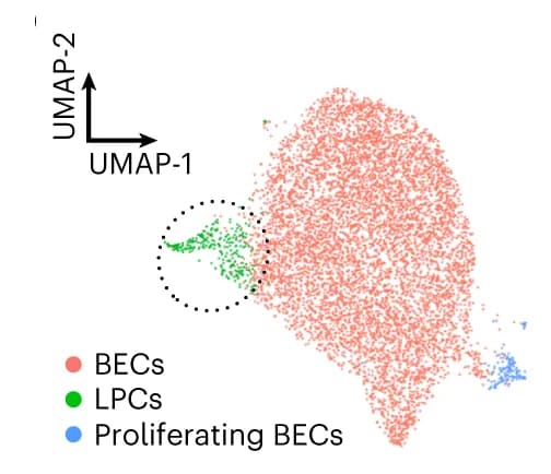 Open access visualization of Scatter Plot, UMAP, EPCAM+ Epithelial Cells, BECs, LPCs