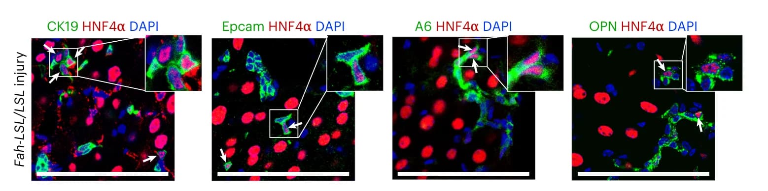 Open access visualization of Microscopy, Immunostaining, HNF4α, CK19, EPCAM