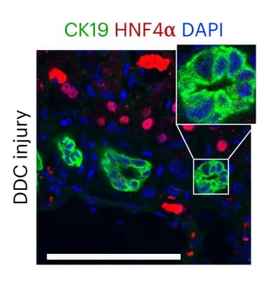 Open access visualization of Microscopy, Immunostaining, CK19, HNF4α, DDC Diet