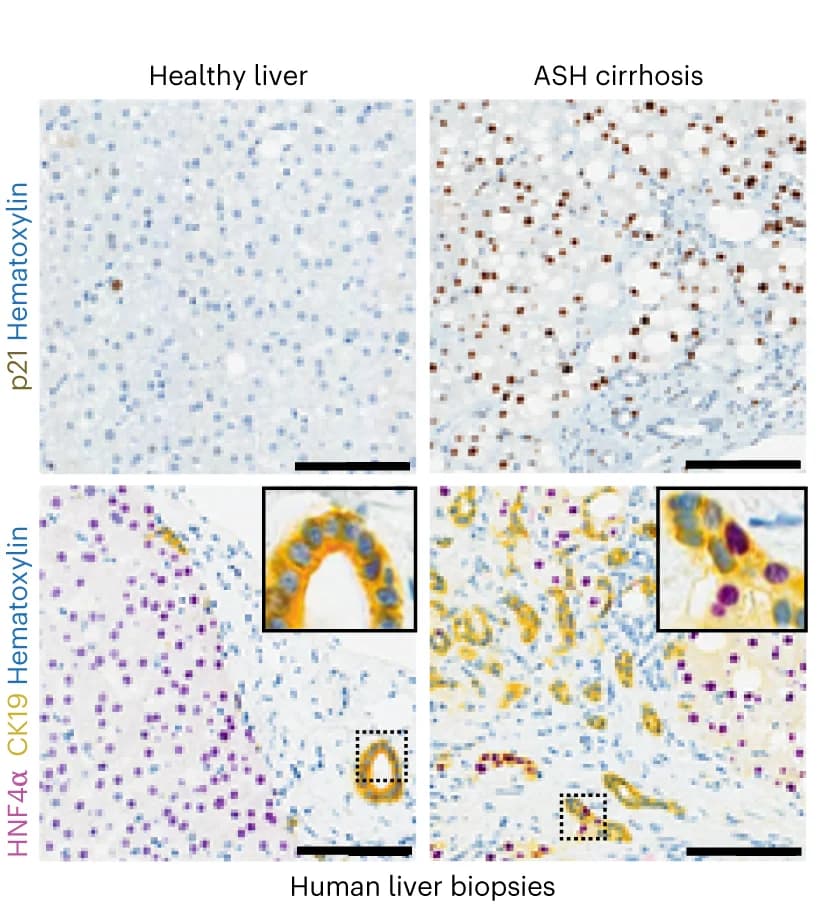 Open access visualization of Microscopy, Immunostaining, p21, CK19, HNF4α