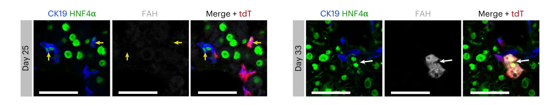 Open access visualization of Microscopy, Immunostaining, tdT, HNF4alpha, CK19