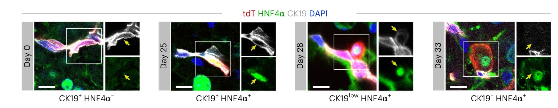Open access visualization of Microscopy, Immunostaining, tdT, HNF4alpha, CK19