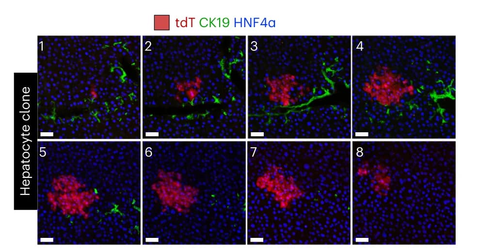 Open access visualization of Microscopy, Immunostaining, tdT, HNF4alpha, CK19