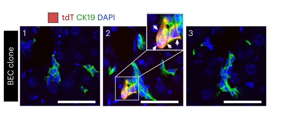 Open access visualization of Microscopy, Immunostaining, tdT, CK19, Liver sections