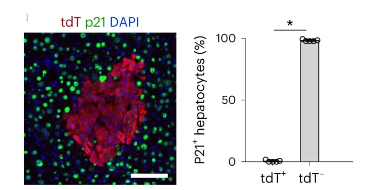 Open access visualization of Bar Plot, Scatter Plot, Immunostaining, tdT, FAH