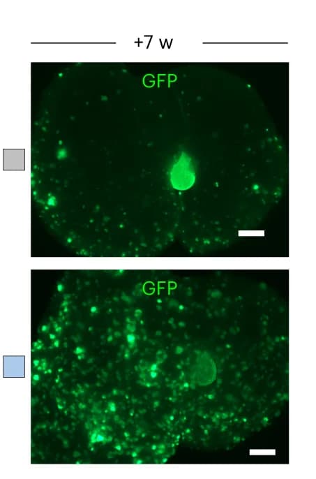 Open access visualization of Microscopy, GFP, Fluorescent liver images, NTBC removal