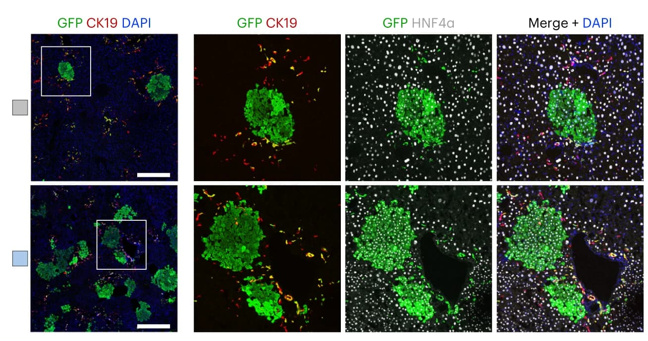Open access visualization of Microscopy, Immunostaining, GFP, HNF4alpha, CK19