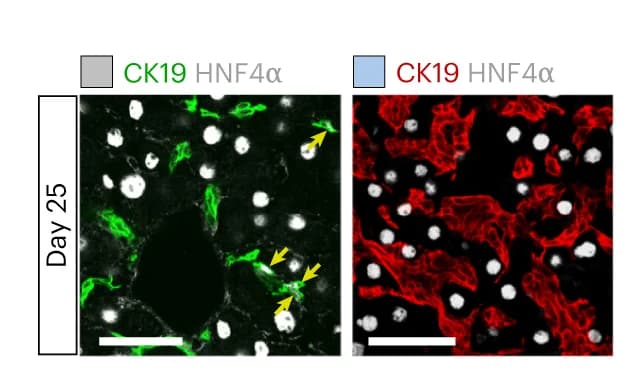 Open access visualization of Microscopy, Immunostaining, HNF4alpha, CK19, Liver Sections