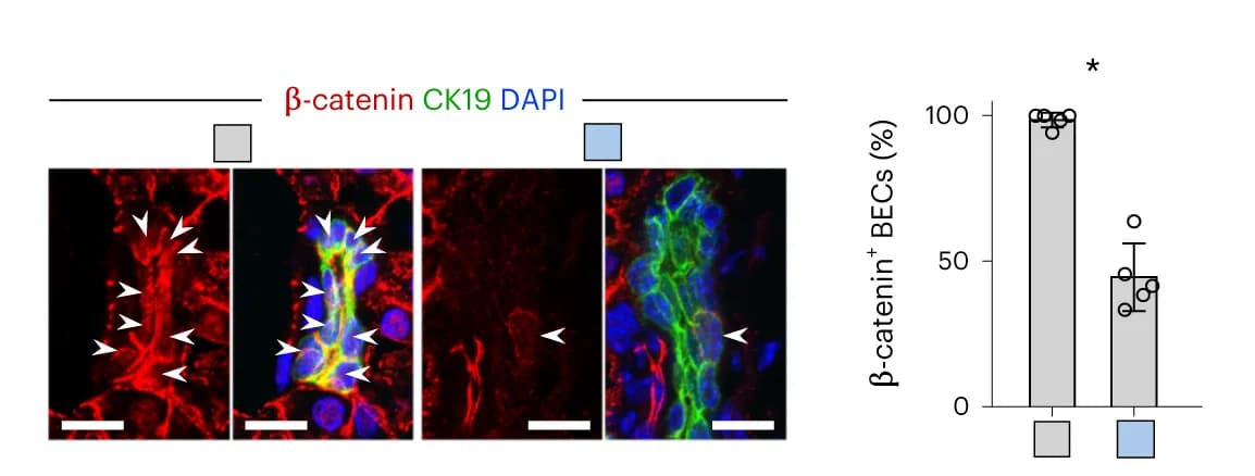Open access visualization of Bar Plot, Error Bars, Microscopy, Immunostaining, CK19