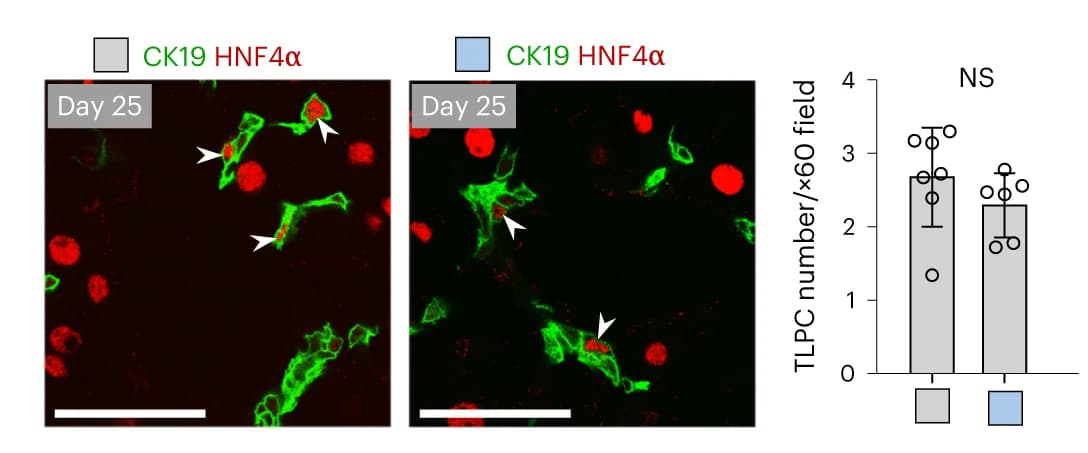 Open access visualization of Bar Plot, Error Bars, Microscopy, Immunostaining, CK19