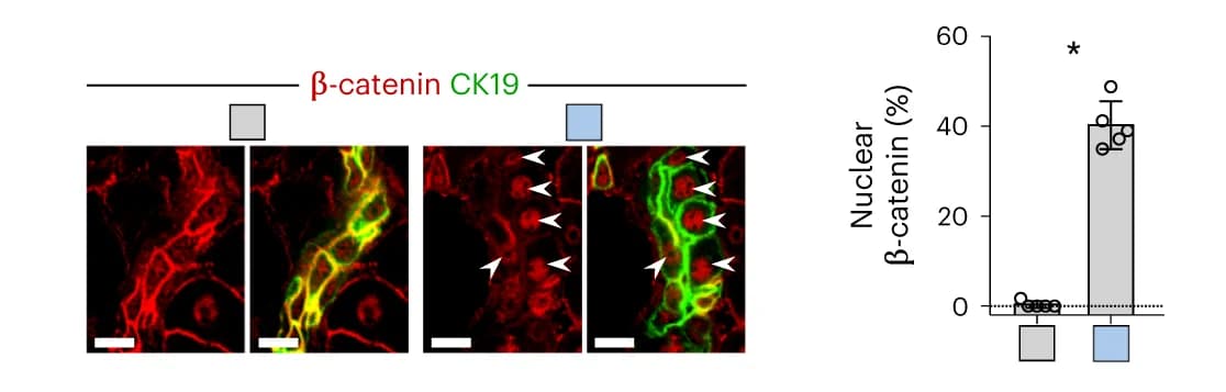 Open access visualization of Bar Plot, Immunostaining, Beta-catenin, CK19, Liver Sections