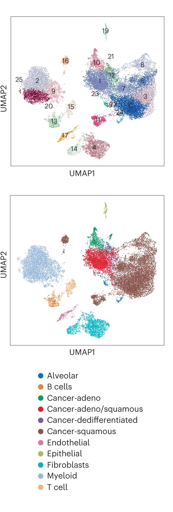 Open access visualization of Scatter Plot, UMAP, Single-cell RNA-seq, NSCLC, Leiden clustering