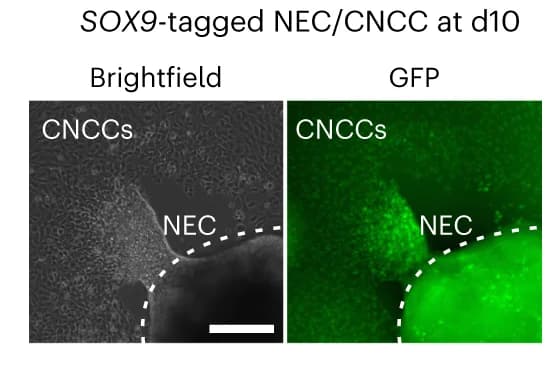 Open access visualization of Microscopy, Live-cell Imaging, mNeonGreen Fluorescence, NEC, CNCC