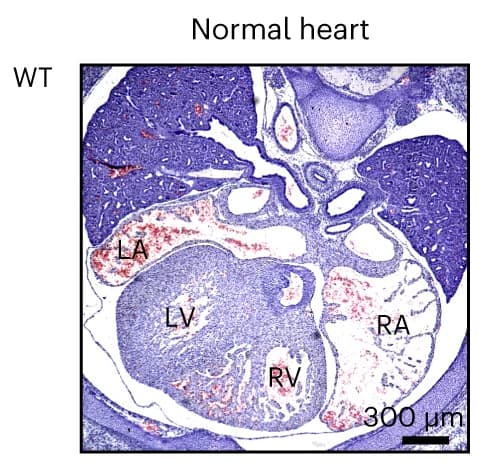 Open access visualization of Microscopy, Mouse Hearts, Hematoxylin and Eosin Staining, Heart Chambers, Embryo