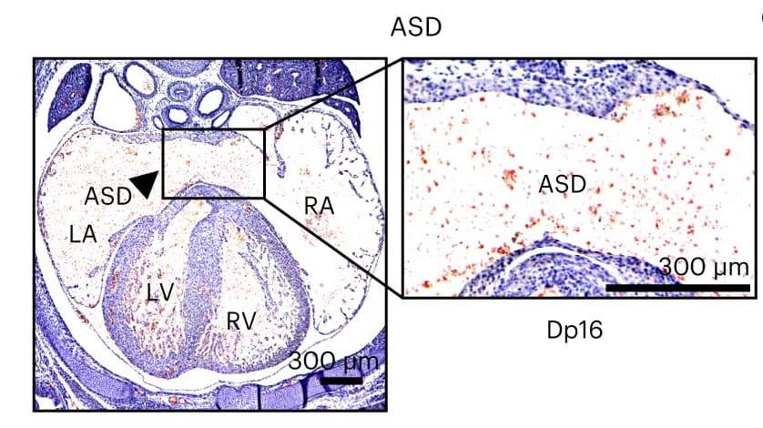 Open access visualization of Microscopy, Mouse Hearts, Hematoxylin and Eosin Staining, ASD, Embryo