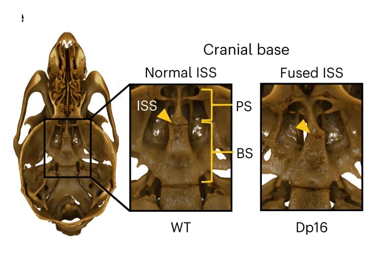 Open access visualization of Photo, Cranial Base, ISS Fusion