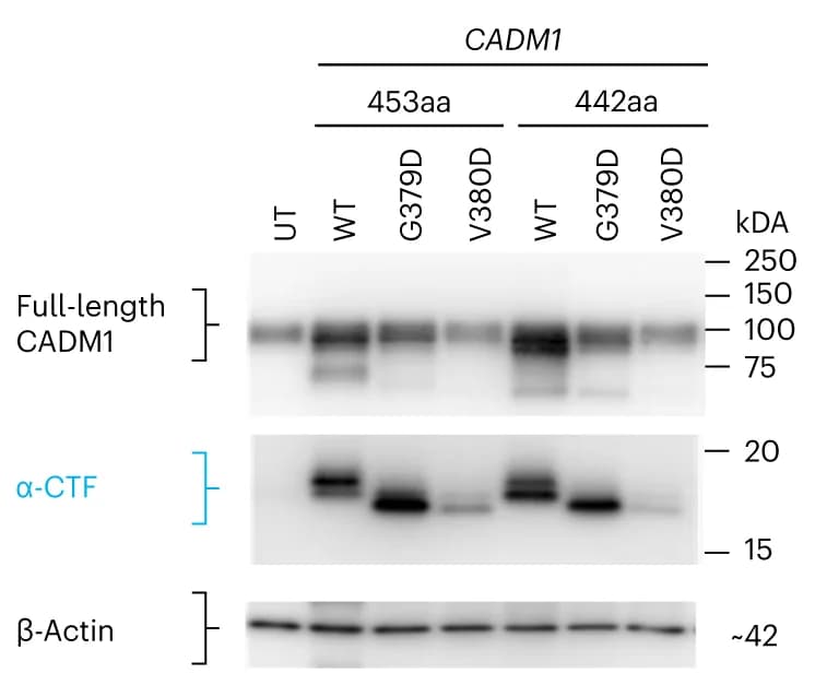 Open access visualization of Gel, CADM1, Western Blot, Cell Lysates, H295R Cells