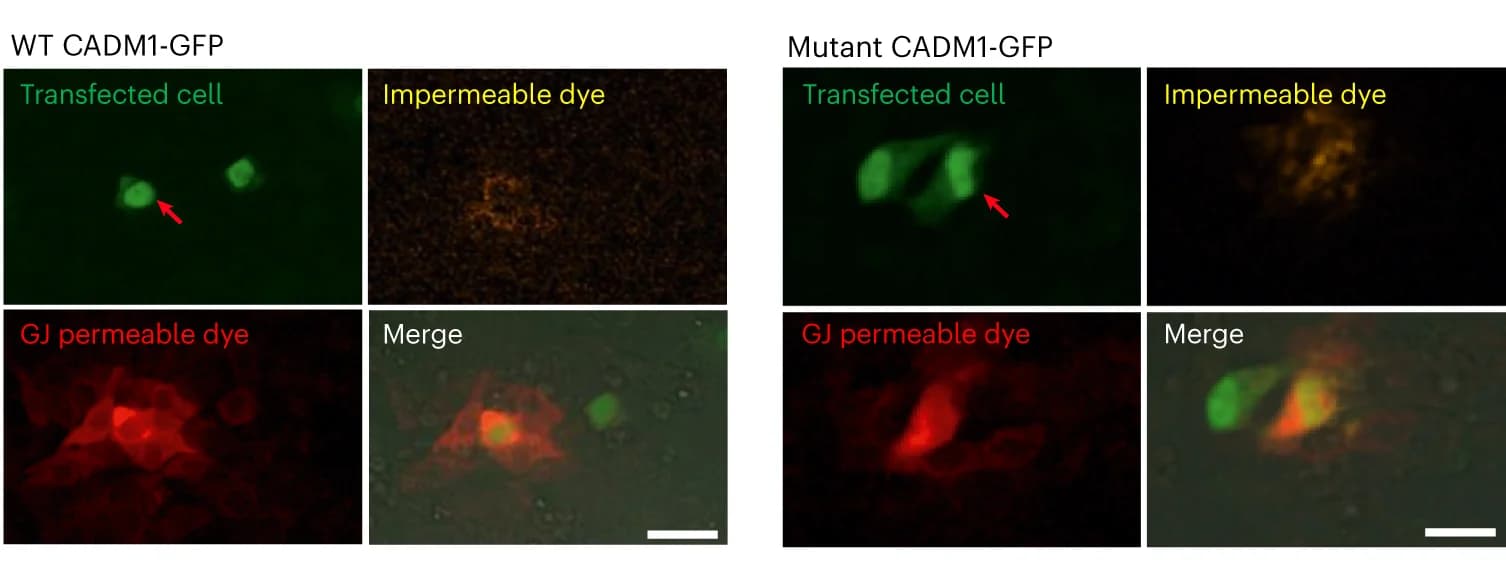 Open access visualization of Microscopy, GJ-mediated communication, H295R cells, CADM1-GFP, GJ-impermeable dye
