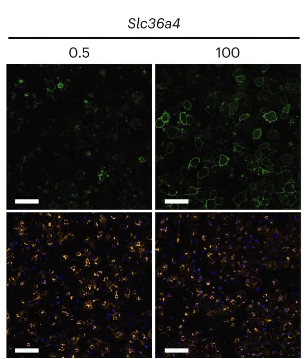 Open access visualization of Microscopy, Fluorescence Microscopy, siRNA Knockdown, 3T3-L1 Adipocytes, Insulin Stimulation