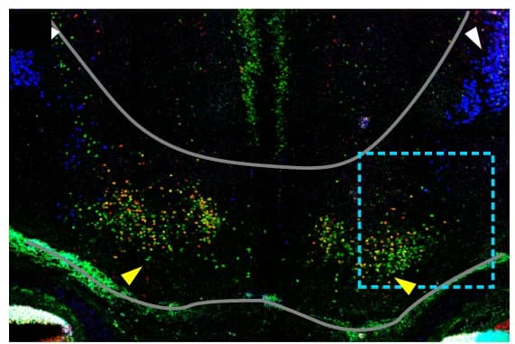 Open access visualization of Microscopy, ISL1, GATA2, GATA3, Immunofluorescence