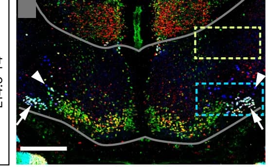 Open access visualization of Microscopy, Hindbrain Sections, Immunofluorescence, r4MNs, IEE VEN Regions