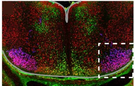 Open access visualization of Microscopy, ISL1, NR2F1, GATA3, Immunofluorescence