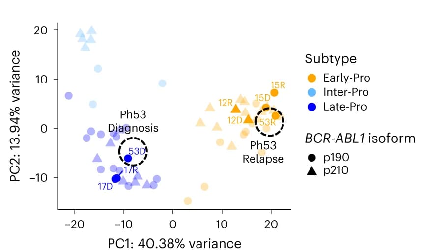Open access visualization of Scatter Plot, PCA, Leukemic Transcriptomes, NMF Component Genes, Diagnosis