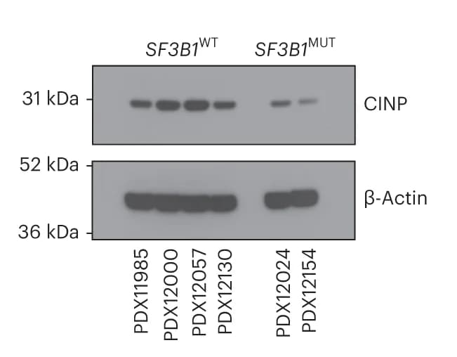 Open access visualization of Gel, Western Blot, CINP, SF3B1 MUT, SF3B1 WT