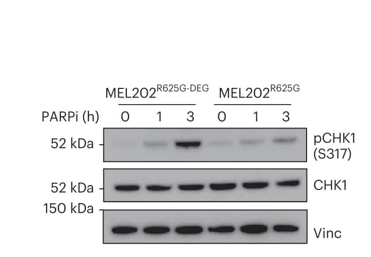 Open access visualization of Gel, Western Blot, CHK1 Phosphorylation, pCHK1 (S317), CHK1 Expression