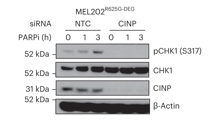 Open access visualization of Gel, Western Blot, pCHK1, CHK1, CINP