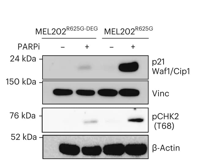 Open access visualization of Gel, Western Blot, Protein Phosphorylation, Biological Replicates, p21