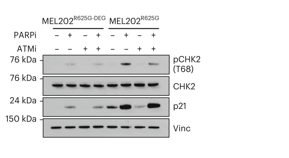 Open access visualization of Gel, Western Blot, pCHK2, Total CHK2, p21 Expression