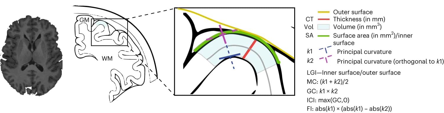 Open access visualization of Illustration, Cortical Thickness, Cortical Surface Area, Gray Matter Volume, Fractal dimension