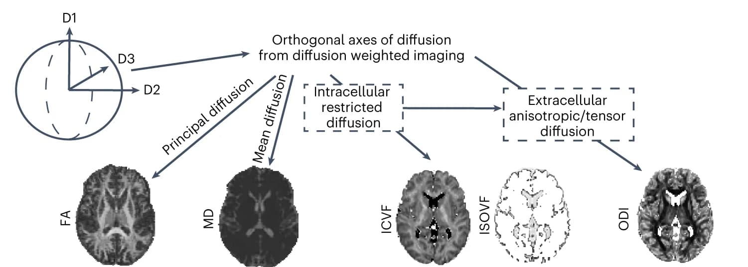 Open access visualization of Workflow, Illustration, Fractional Anisotropy, Mean Diffusivity, Intracellular Volume Fraction