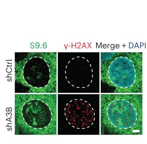 Open access visualization of Microscopy, IF Images, U2OS shCtrl Cells, shA3B Cells, S9.6