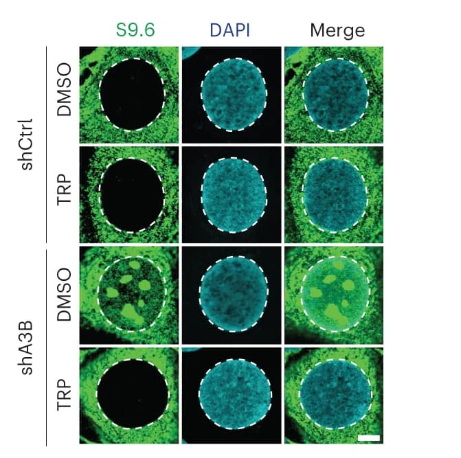 Open access visualization of Microscopy, IF Images, U2OS shCtrl Cells, U2OS shA3B Cells, TRP