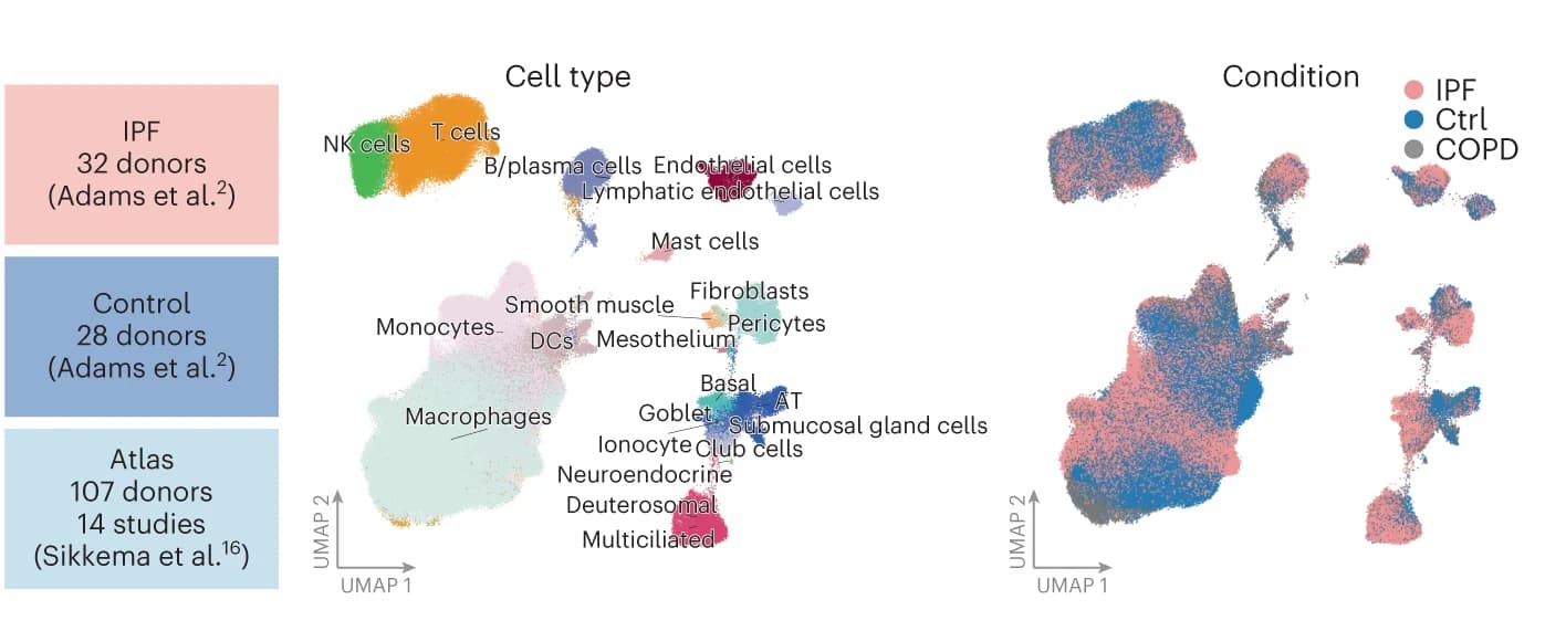 Open access visualization of Scatter Plot, UMAP, IPF, Control, Atlas Dataset