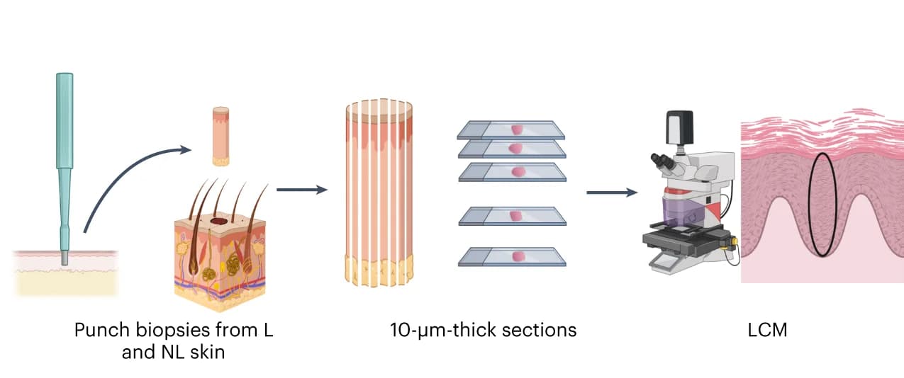 Open access visualization of Workflow, Illustration, Sampling Pipeline, Punch Biopsies, Lesional Skin