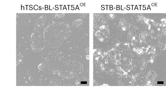 Open access visualization of Microscopy, Bright-Field Images, hTSCs-BL-STAT5A OE, STB-BL-STAT5A OE