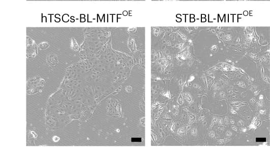 Open access visualization of Microscopy, Bright-Field Images, hTSCs-BL-MITF OE, STB-BL-MITF OE