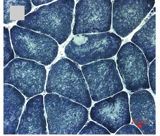 Open access visualization of Microscopy, Muscle Histopathology, Minicores, Core-like Structures, NADH Histochemistry