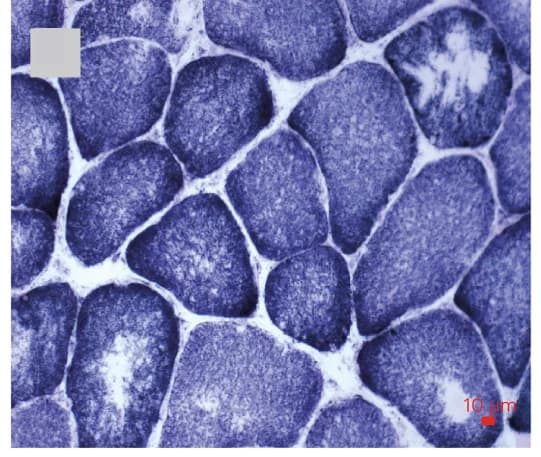 Open access visualization of Microscopy, Photo, Gel, Muscle Histopathology, Minicores