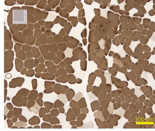 Open access visualization of Microscopy, Muscle Histopathology, Type I Fiber Predominance, Type I Uniformity, ATPase Staining