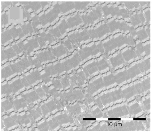 Open access visualization of Microscopy, Muscle Histopathology, EM Images, Core Structures, Z-line Misalignment