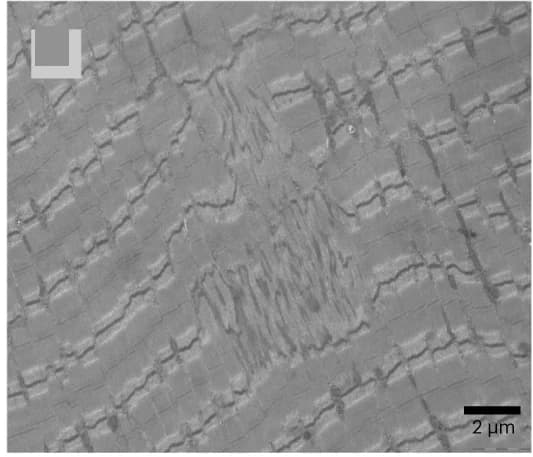 Open access visualization of Microscopy, Muscle Histopathology, EM Images, Core Structures, Z-line Misalignment
