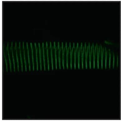 Open access visualization of Microscopy, Photo, Myofiber Immunostaining, Electron Microscopy, Skeletal Fast Muscle Fibers