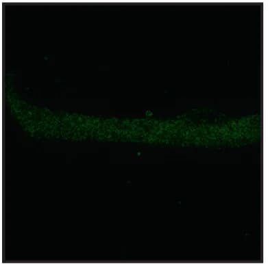 Open access visualization of Microscopy, Myofiber Immunostaining, Electron Microscopy, Skeletal Fast Muscle Fibers, srpk3 − / − ; ttn.1 +/ −