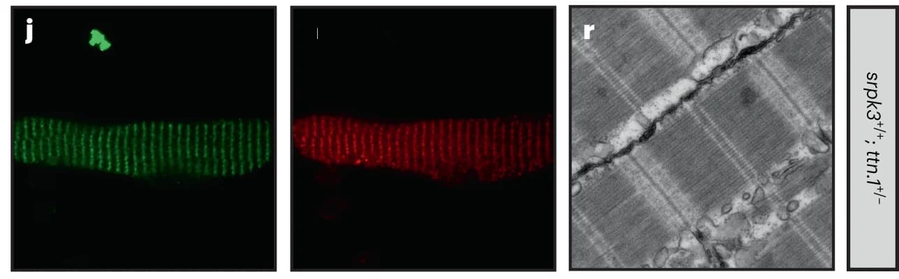 Open access visualization of Microscopy, Myofiber Immunostaining, Electron Microscopy, Skeletal Fast Muscle Fibers, srpk3 +/+ ; ttn.1 +/ −