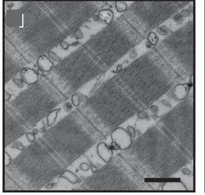 Open access visualization of Microscopy, Myofiber Immunostaining, Electron Microscopy, Skeletal Fast Muscle Fibers, WT