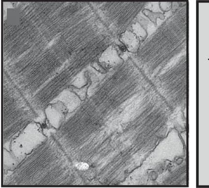 Open access visualization of Microscopy, Myofiber Immunostaining, Electron Microscopy, Skeletal Fast Muscle Fibers, srpk3 − / − ; ttn.1 +/ −